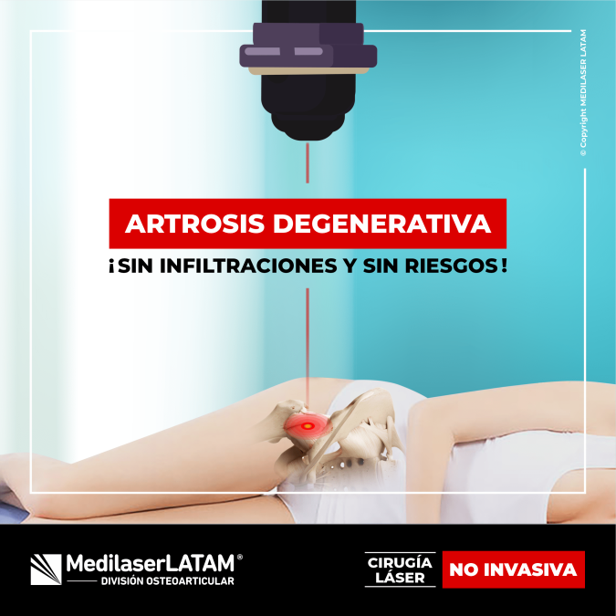 Artrosis degenerativa de cadera: tratamiento láser regenera cartílago sin cirugía. 92% alivia dolor, 85% evita prótesis. Consulta ahora.