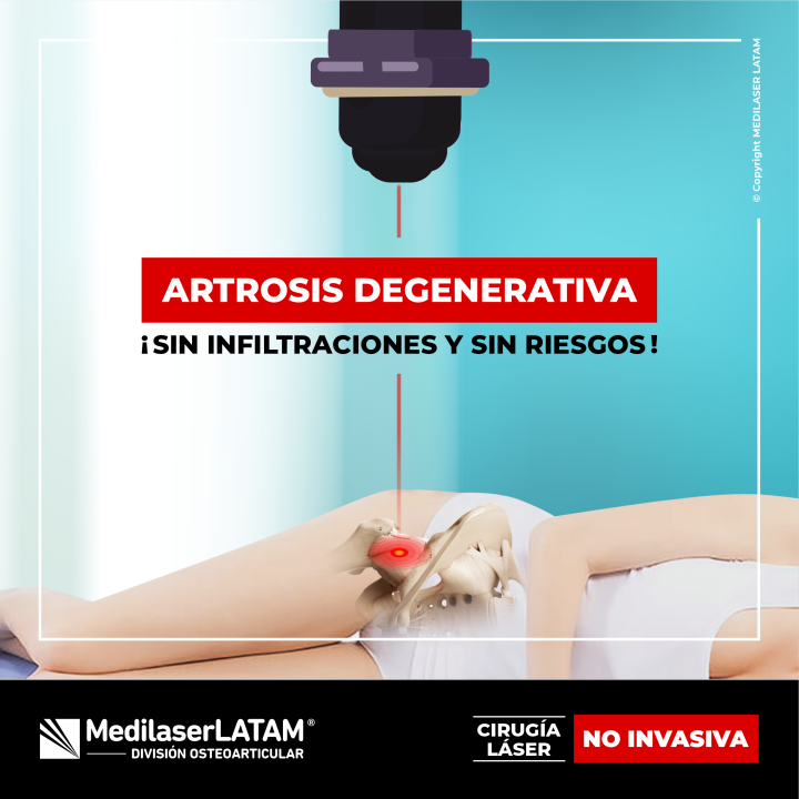 Artrosis degenerativa de cadera: tratamiento láser regenera cartílago sin cirugía. 92% alivia dolor, 85% evita prótesis. Consulta ahora.