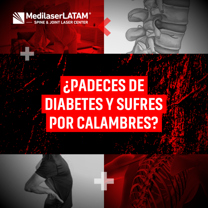 Calambres frecuentes en diabéticos: ¿relación con artrosis o neuropatía? Soluciones para aliviar el dolor y mejorar circulación.