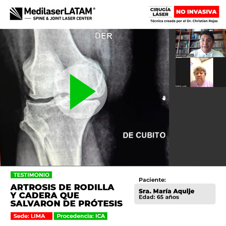 Testimonio real de la Sra. María Aquije (Ica, Perú) que evitó la prótesis de rodilla y cadera gracias al tratamiento láser no invasivo.