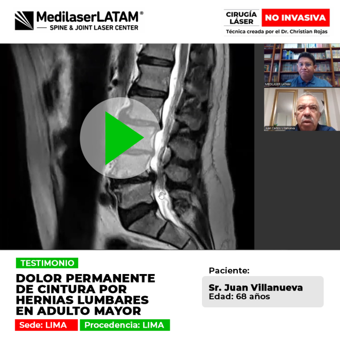 Dolor permanente cintura: Juan Villanueva (68) superó las hernias lumbares que le causaban dolor constante. Vea cómo la cirugía láser no invasiva frenó el deterioro.