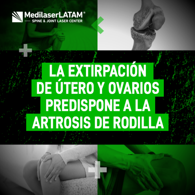 Extirpación útero artrosis: El Dr. Rojas explica la relación hormonal entre la histerectomía y el deterioro de la rodilla. La cirugía láser frena el desgaste.