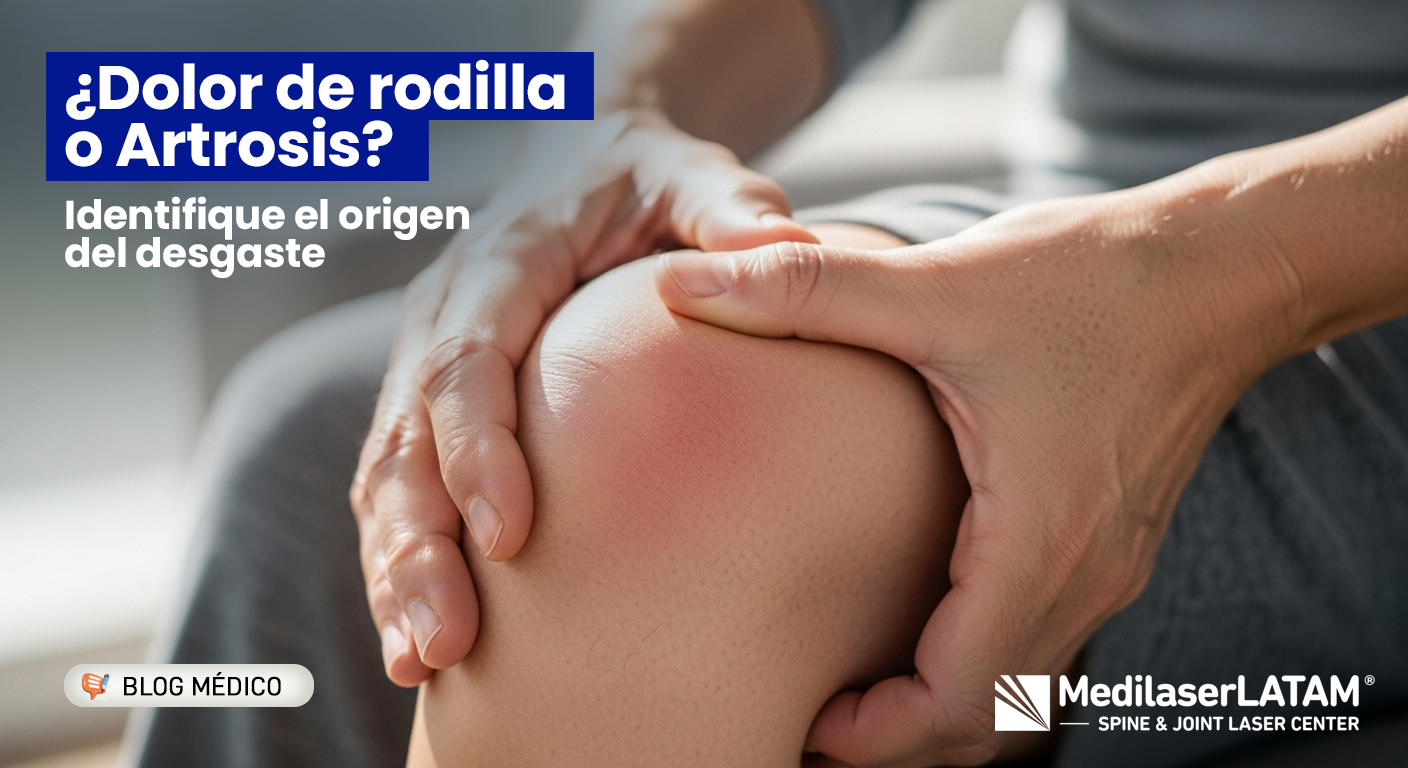 ¿Siente dolor al bajar escaleras? Identifique si es Artrosis de rodilla y conozca cómo evitar la prótesis con tecnología láser.
