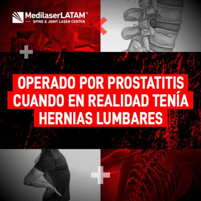 Operado por supuesta prostatitis sin éxito. El Dr. Rojas revela cómo las hernias lumbares simulan síntomas urinarios y su solución láser.