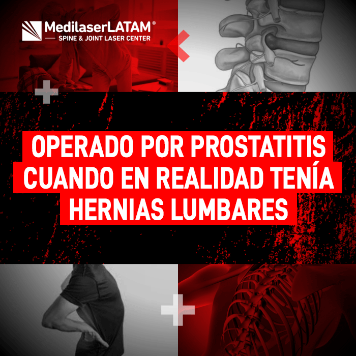 Operado por supuesta prostatitis sin éxito. El Dr. Rojas revela cómo las hernias lumbares simulan síntomas urinarios y su solución láser.