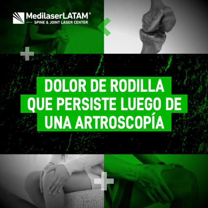 Dolor de rodilla tras una artroscopía: por qué la cirugía no siempre es la solución definitiva y cómo tratar la molestia persistente.