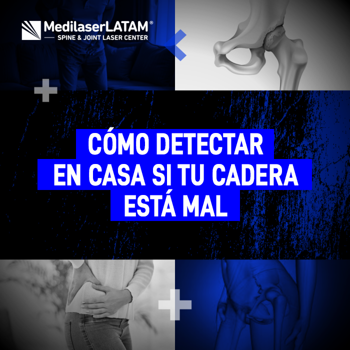 Detectar si tu cadera está mal es posible con esta prueba de 10 segundos. Identifica el desgaste articular a tiempo y evita que tu cadera se pegue.
