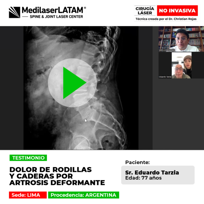 Dolor de rodillas y caderas por Artrosis deformante. Recupere su calidad de vida y vuelva a caminar sin dolor con nuestro tratamiento láser.