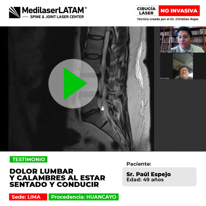Dolor lumbar y calambres al estar sentado y conducir. Conoce cómo nuestro tratamiento láser ayuda a aliviar estos síntomas de forma efectiva.