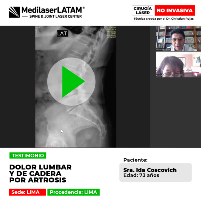 Dolor lumbar y de cadera por Artrosis. Elimine el malestar y recupere su autonomía con nuestra técnica láser exclusiva.