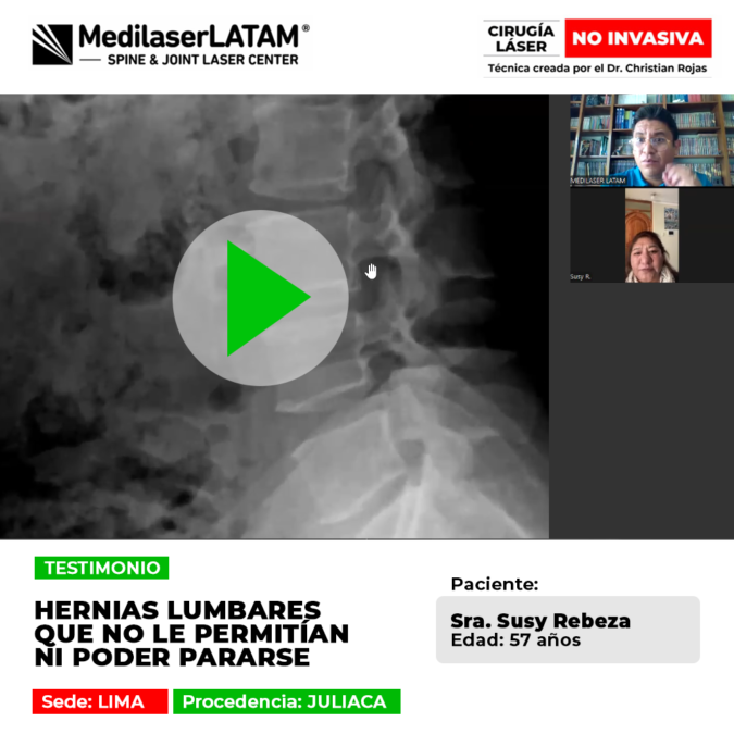 Testimonio de recuperación de Hernias lumbares severas. Paciente vuelve a caminar y ponerse de pie gracias a nuestra tecnología láser avanzada.