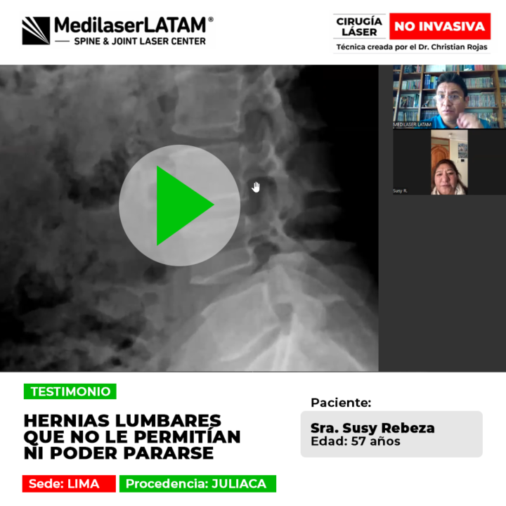 Testimonio de recuperación de Hernias lumbares severas. Paciente vuelve a caminar y ponerse de pie gracias a nuestra tecnología láser avanzada.