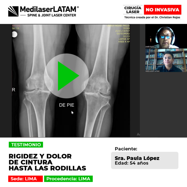 Paciente logra superar la rigidez y el dolor crónico que se extendía desde la cintura hasta las rodillas. Conoce su recuperación con láser.