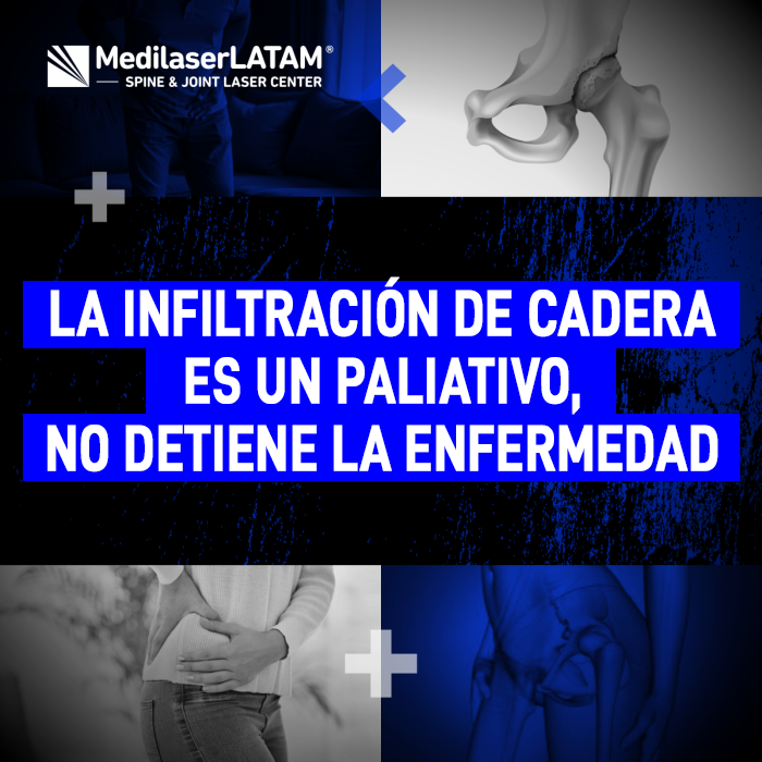 Infiltración de cadera es un paliativo. Descubre por qué este procedimiento no detiene la enfermedad con la explicación del Dr. Rojas.