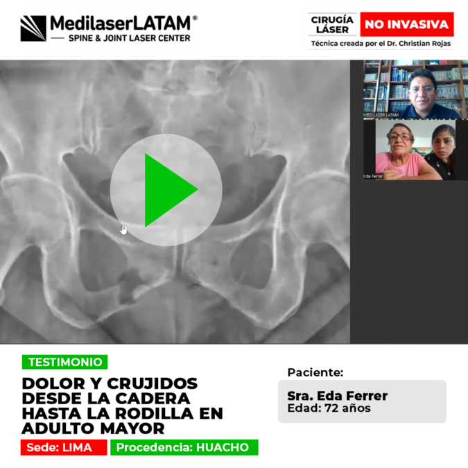 Sintomatología de dolor y crujidos articulares en miembros inferiores durante el adulto mayor y opciones de tratamiento médico especializado.