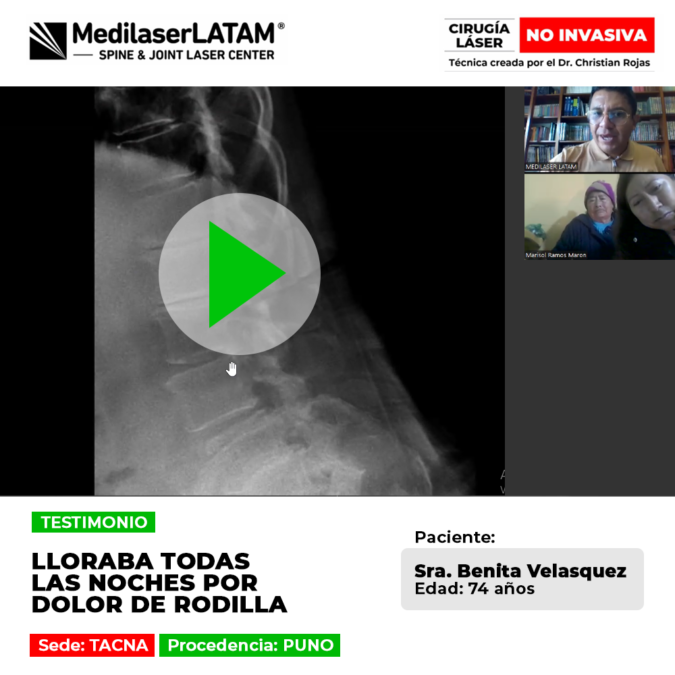 Dolor de rodilla nocturno: testimonio de una paciente de Puno que logró eliminar el sufrimiento crónico gracias al tratamiento láser avanzado.