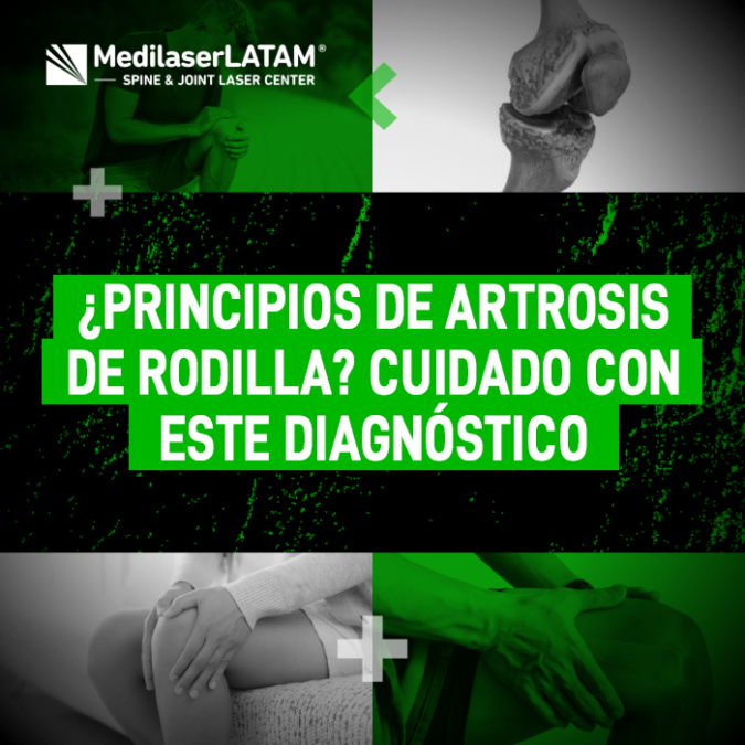 ¿Te diagnosticaron inicios de desgaste articular? Conoce la importancia de una evaluación precisa para proteger la salud de tus rodillas.