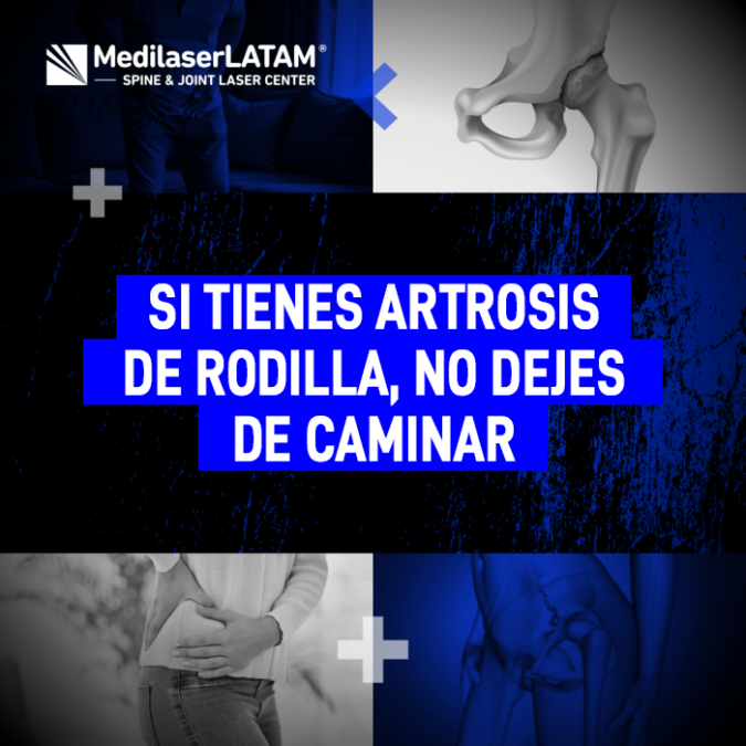 Mantener la movilidad es clave. Descubre por qué caminar ayuda a tu recuperación y cómo fortalecer tus rodillas con artrosis.