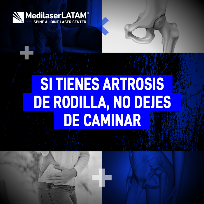 Mantener la movilidad es clave. Descubre por qué caminar ayuda a tu recuperación y cómo fortalecer tus rodillas con artrosis.