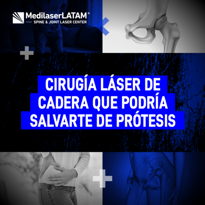 Descubre cómo la tecnología médica avanzada permite tratar el desgaste de cadera a tiempo, evitando intervenciones quirúrgicas mayores.