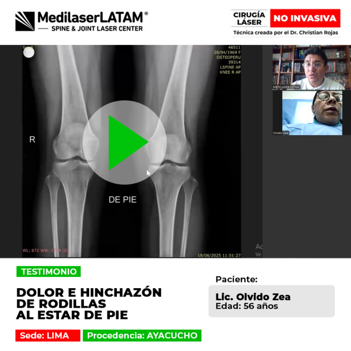 ¿El dolor de rodilla no te deja estar de pie? Conoce la solución tecnológica para desinflamar las articulaciones y volver a caminar bien.