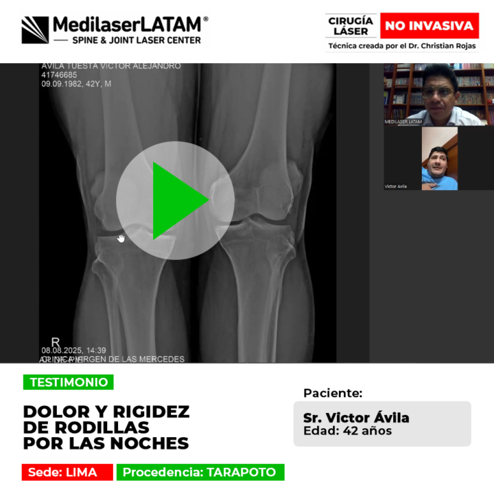 ¿Sufres de rodillas rígidas e inflamadas al descansar? Conoce el tratamiento láser efectivo para aliviar el dolor nocturno.