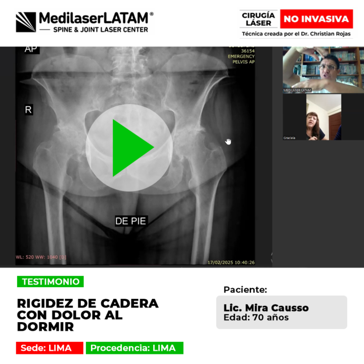 ¿El dolor de cadera no te deja descansar por las noches? Descubre la alternativa tecnológica para aliviar la rigidez articular hoy.