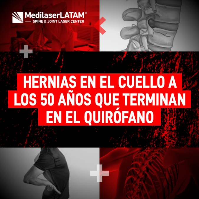 Evita una cirugía invasiva. Infórmate sobre cómo el desgaste cervical severo puede agravarse a los 50 años y qué alternativas existen.