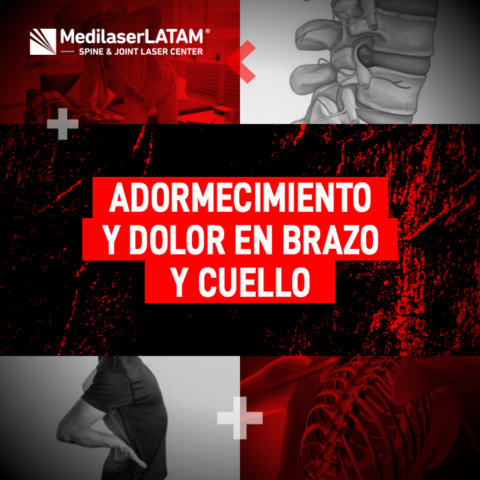 Si sientes hormigueo en las extremidades y rigidez cervical, descubre qué problemas de la columna podrían estar presionando tus nervios.