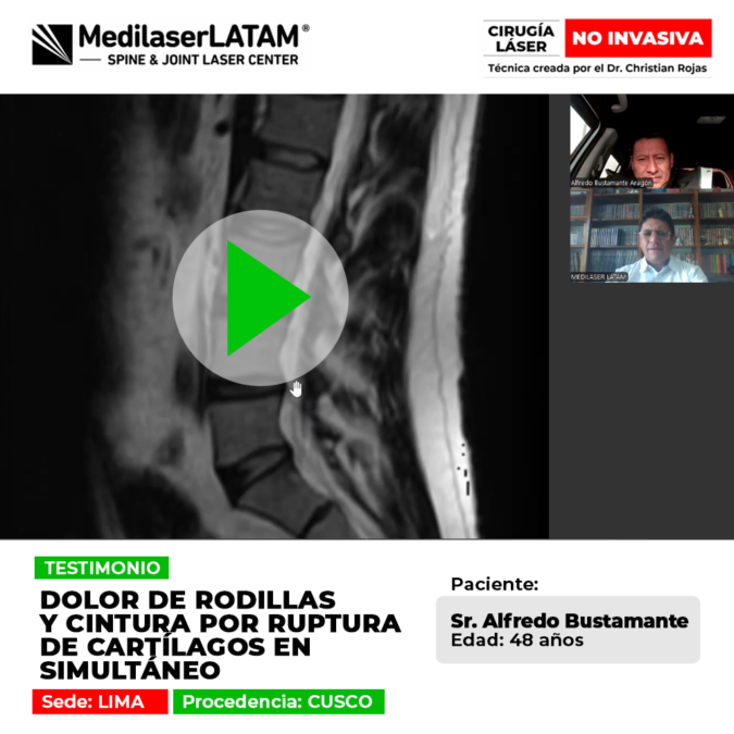 Conoce la historia de superación de un paciente con desgaste severo y simultáneo de cartílagos en rodillas y zona lumbar.