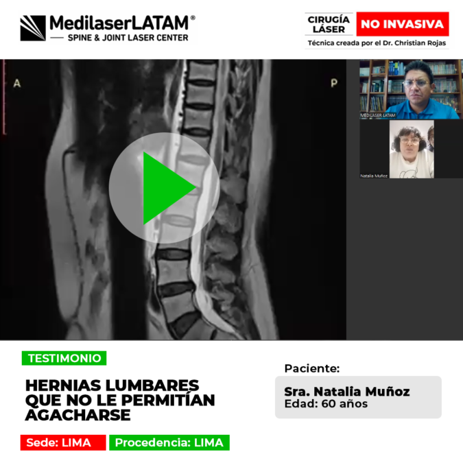 Conoce la historia de una paciente que recuperó la movilidad y la flexibilidad tras sufrir de severas hernias en la zona lumbar.