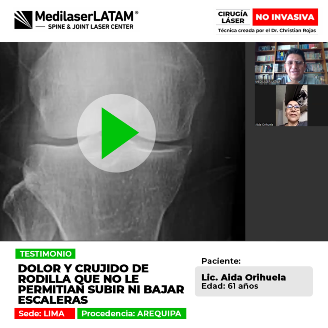 Una mirada al tratamiento tecnológico que ayudó a una licenciada a superar el desgaste articular y los molestos ruidos en sus rodillas.