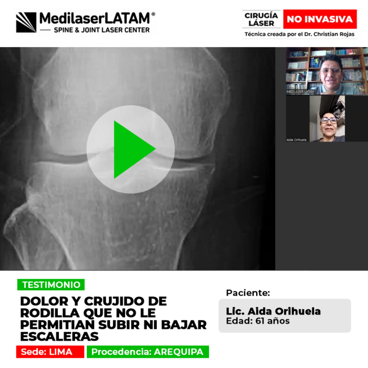 Una mirada al tratamiento tecnológico que ayudó a una licenciada a superar el desgaste articular y los molestos ruidos en sus rodillas.