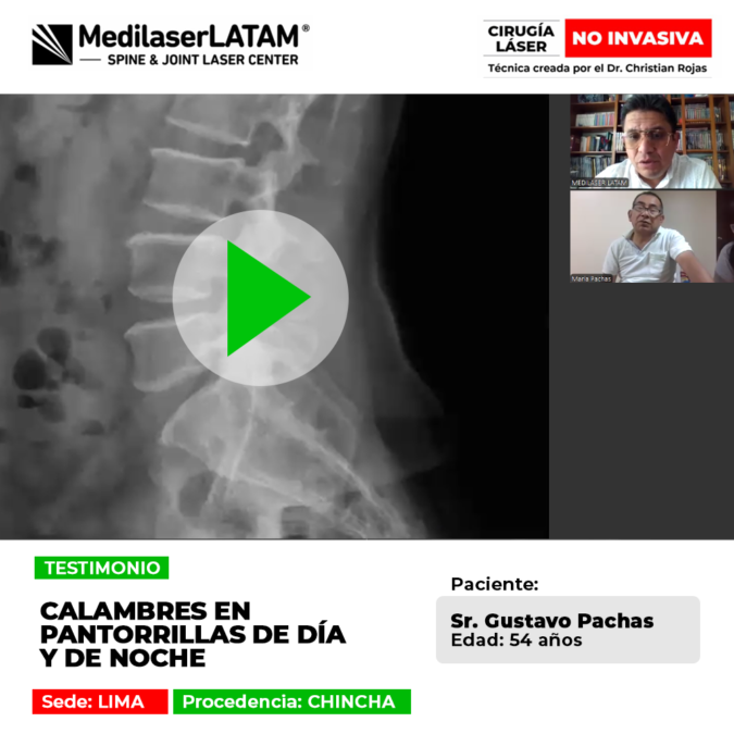 ¿Sufres de espasmos musculares continuos que interrumpen tu descanso? Conoce el testimonio de un paciente que superó los intensos calambres nocturnos y diurnos.