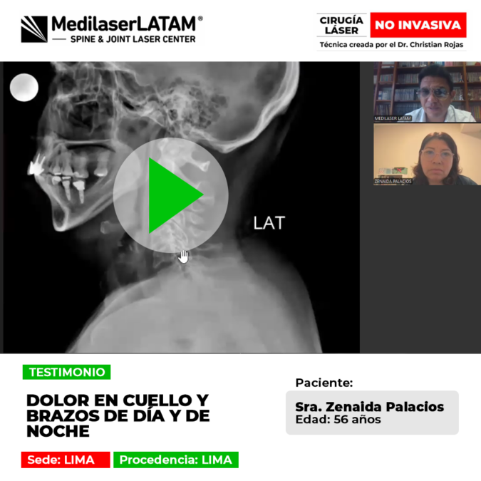 Conoce la historia de la paciente que alivió el dolor cervical persistente que afectaba su descanso las 24 horas.