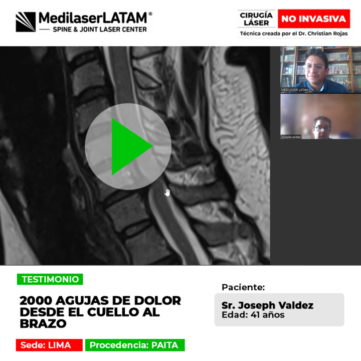 ¿Sientes hincadas como agujas en tus extremidades? Conoce el testimonio del paciente que superó este severo síntoma cervical.