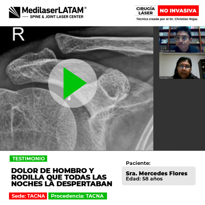 Una mirada al tratamiento médico que devolvió el descanso nocturno a una paciente que sufría por desgaste articular severo.