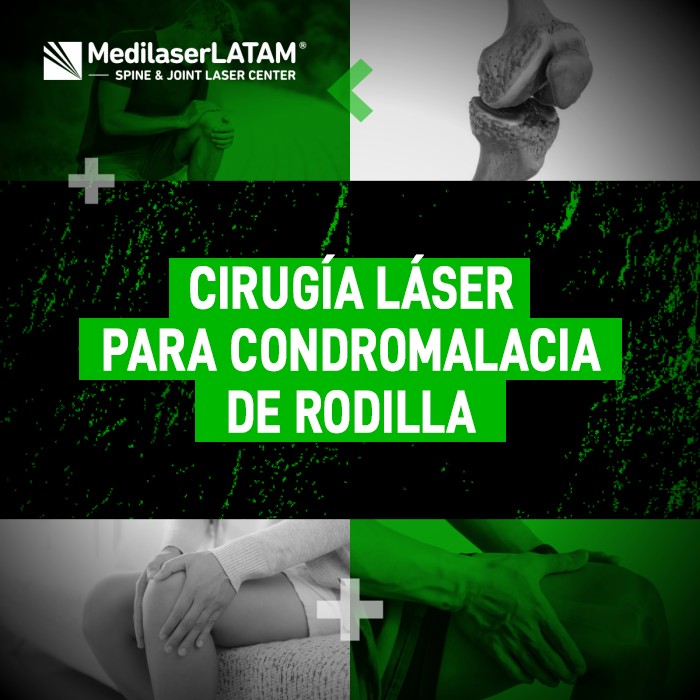 La condromalacia de rodilla desgasta el cartílago y causa un dolor persistente. Descubre cómo actúa la cirugía láser en tu articulación.