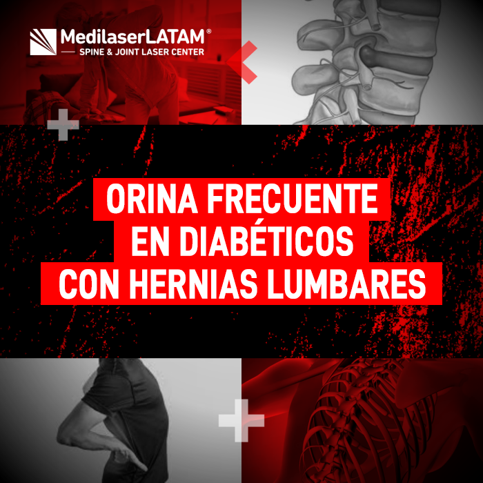 Infórmate sobre la relación entre la micción constante y la compresión nerviosa causada por las hernias lumbares en pacientes con diabetes.