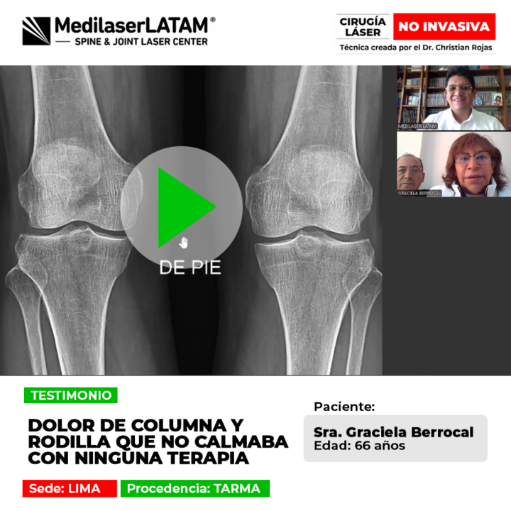 Conoce el testimonio de la paciente que superó un persistente dolor de columna y rodilla que no cedía ante los tratamientos convencionales.