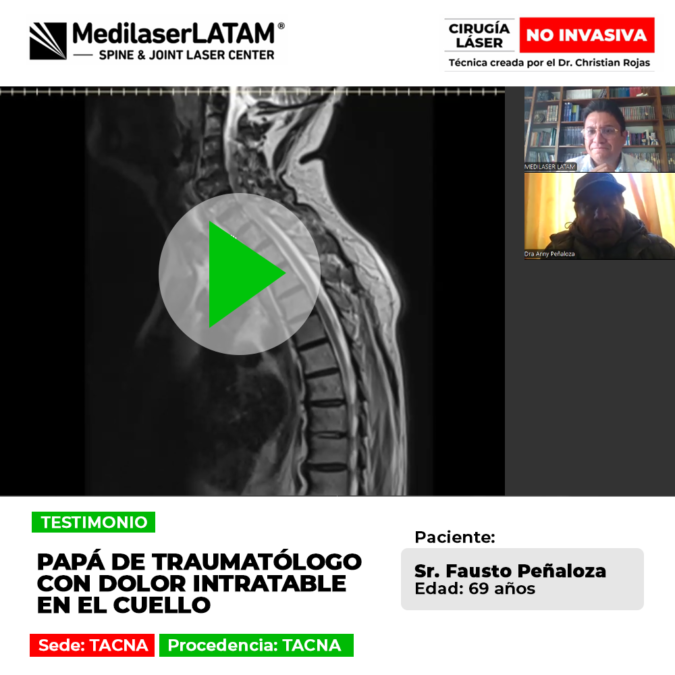 El dolor intratable en el cuello afectaba al papá de un traumatólogo en Tacna. Mira cómo logró superar su condición y aliviar su dolor.