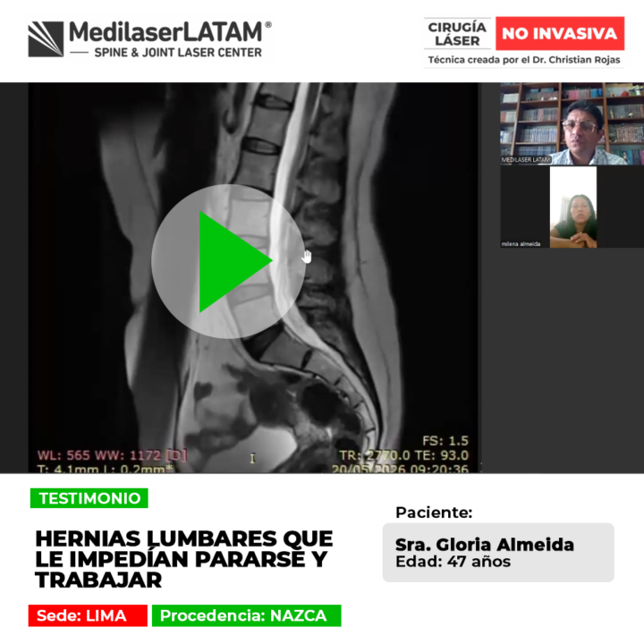 Las hernias lumbares severas llegan a impedir ponerse de pie o trabajar con normalidad. Infórmate sobre soluciones especializadas.