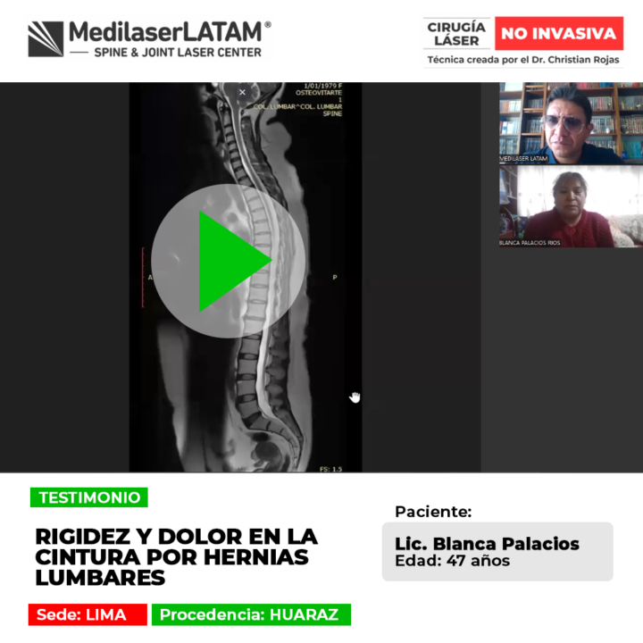 Las hernias lumbares provocan rigidez articular y dolor agudo en la cintura. Infórmate sobre procedimientos médicos para lograr alivio.